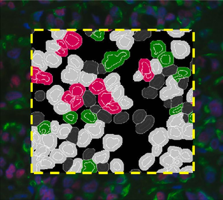 Immunofluorescence – Fluorescent Immunohistochemistry Image Analysis Immunofluorescence – Fluorescent Immunohistochemistry Image Analysis